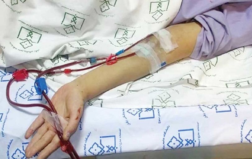 
بیماران پیوندی در معرض خطر رد عضو