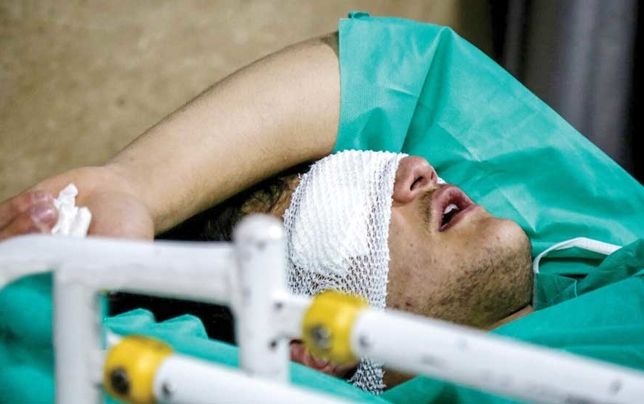 توضیح وزارت بهداشت درباره درمان آسیب‌دیدگان چشمی حوادث اخیر